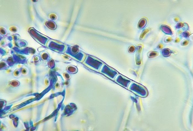 Nấm Sporotrichum gây bệnh là một loài nấm lưỡng hình gây bệnh cho cả con người và động vật